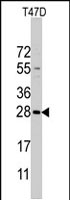PAB2194 - PEMT