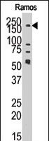 PAB2196 - JMJD1B / KDM3B