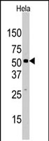 PAB2197 - JMJD2D / KDM4D