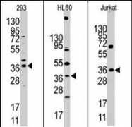 PAB2198 - HIF1AN / FIH1