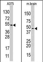 PAB2199 - HIF1AN / FIH1