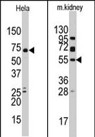 PAB2201 - JMJD4
