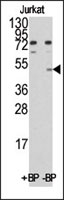 PAB2203 - MYC-induced nuclear antigen