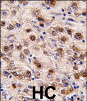 PAB2203 - MYC-induced nuclear antigen
