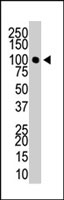 PAB2204 - DNMT3A
