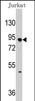 PAB2205 - DNMT3A