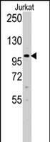 PAB2206 - DNMT3A