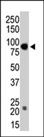 PAB2207 - DNMT3B