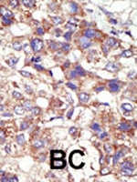 PAB2207 - DNMT3B