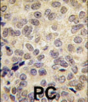 PAB2207 - DNMT3B