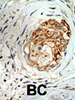 PAB2214 - MBD3