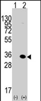 PAB2214 - MBD3