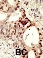 PAB2218 - DNMT3L