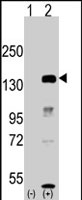 PAB2222 - KDM2A / FBXL11