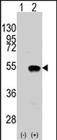 PAB2223 - SMYD2