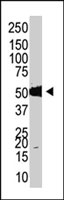 PAB2228 - DNMT2 / TRDMT1