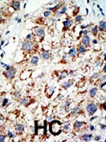 PAB2233 - SAE2 / UBA2