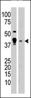 PAB2234 - MBD2