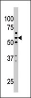 PAB2247 - KAT5