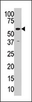 PAB2248 - KAT5
