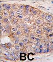 PAB2253 - UBTD1