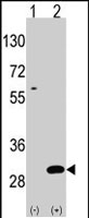 PAB2253 - UBTD1