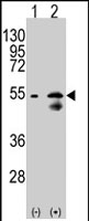 PAB2255 - SLC29A1 / ENT1