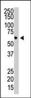 PAB2257 - PIAS4