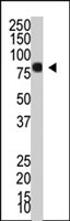 PAB2258 - PIAS4