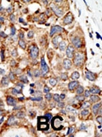 PAB2258 - PIAS4