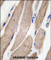 PAB2270 - MAP2K5