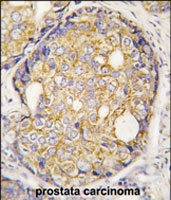 PAB2279 - MEKK5 / ASK1