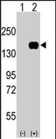 PAB2279 - MEKK5 / ASK1