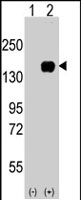PAB2280 - MEKK5 / ASK1