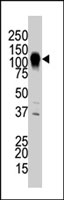 PAB2281 - MEKK6 / ASK2