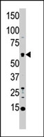 PAB2295 - STK4