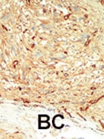 PAB2295 - STK4