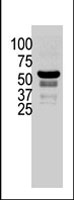 PAB2299 - PAK2