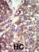 PAB2299 - PAK2