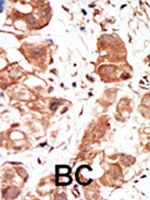 PAB2304 - PIM1