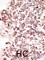 PAB2305 - PIM2