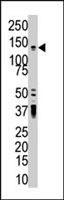 PAB2306 - PKD2