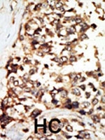 PAB2306 - PKD2