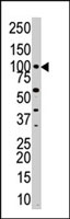 PAB2307 - PKN3