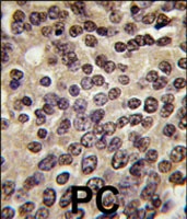 PAB2307 - PKN3