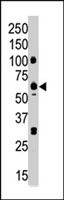 PAB2309 - PLK1
