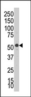 PAB2319 - SGK2