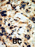PAB2319 - SGK2