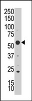 PAB2320 - SGK3 / SGKL