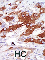 PAB2320 - SGK3 / SGKL